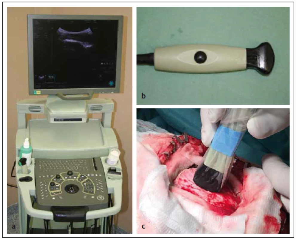 Sonografický přístroj a sonda k intraoperativní sonografii.
Fig. 2. Ultrasound device and ultrasound probe for the intraoperative use.