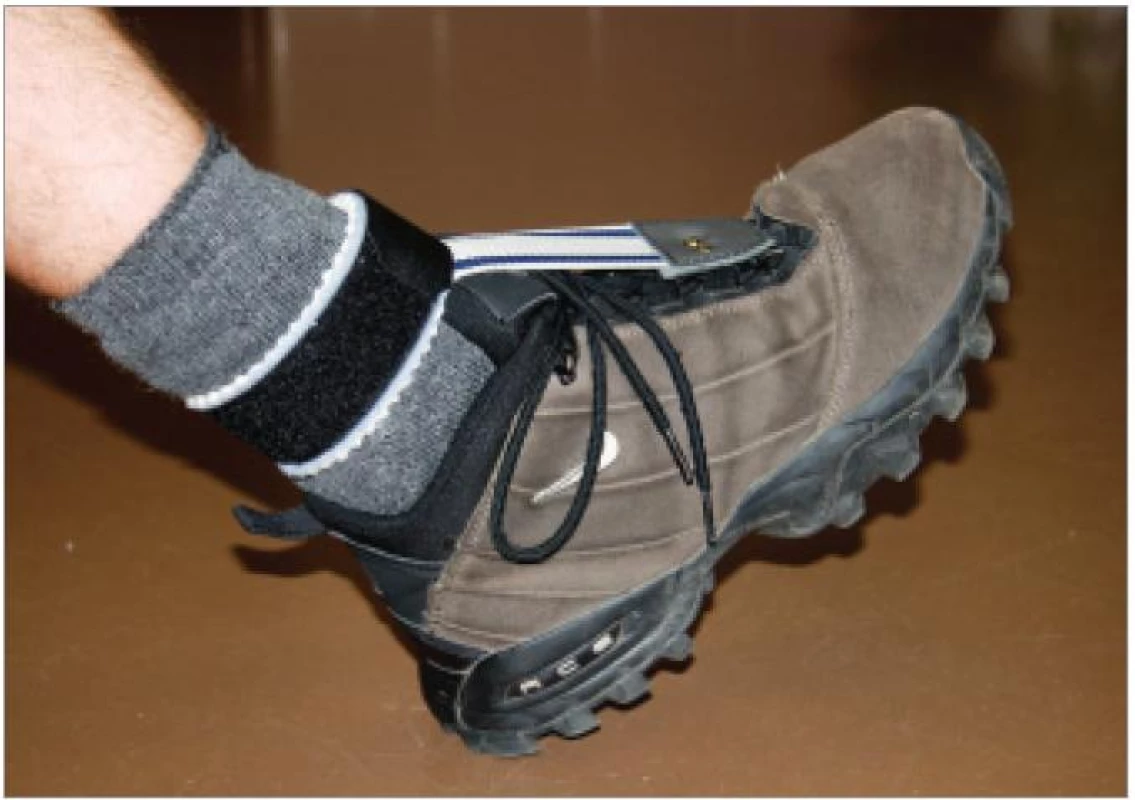 Na sportování doporučujeme užívání kotníkové obuvi stabilizující hlezno, ev. doplníme krátkou peroneální pásku.