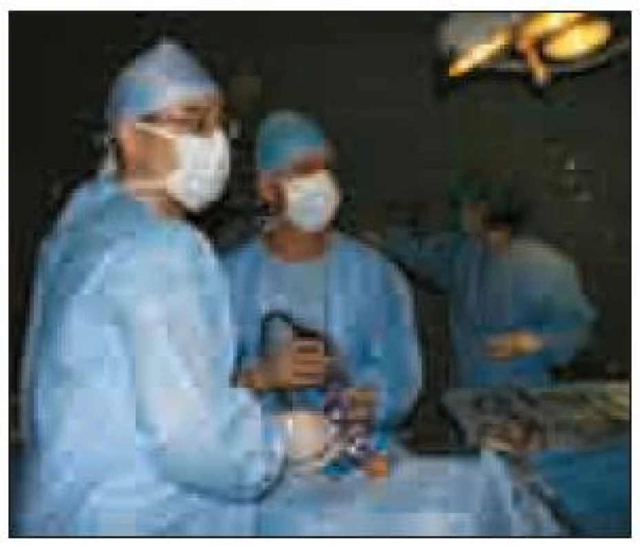 Pohled na operační tým během transnazální endoskopické exstirpace adenomu hypofýzy.
