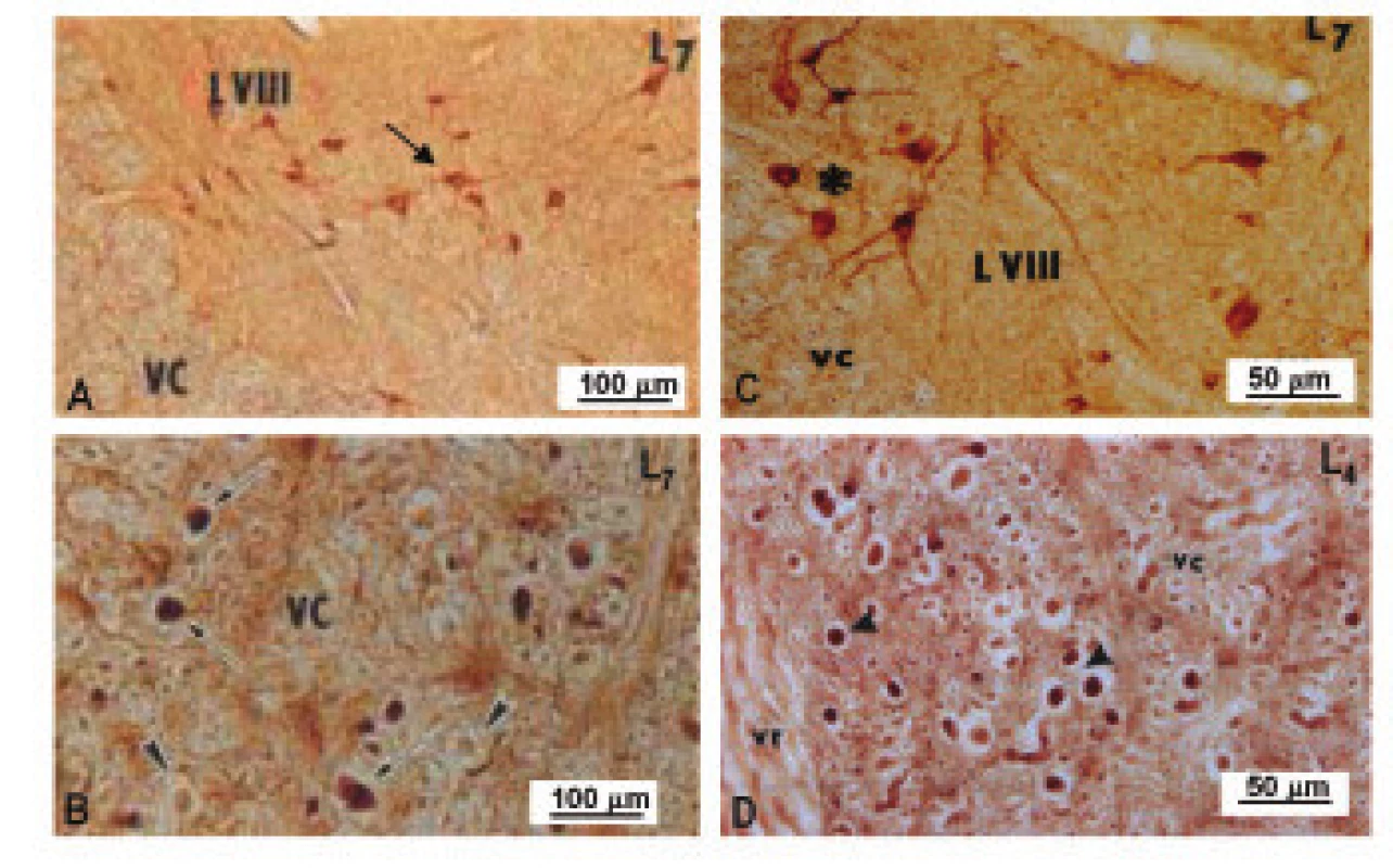 Obrázok, znázorňujúci nNOS-imunoreaktivitu vo ventrálnej časti dolnej lumbálnej miechy u kontroly (A,B) a 5 dní po navodení 4-násobnej konstrikcie cauda equina (C,D). 