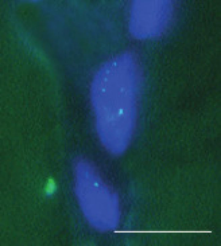 Tečkovité signály retinované RNA v subsarkolematických jádrech svalových vláken u MD2, FISH. Úsečka – 10 μm.