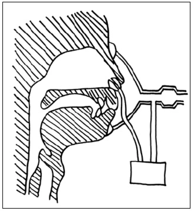 Schéma přední rinomanometrie.