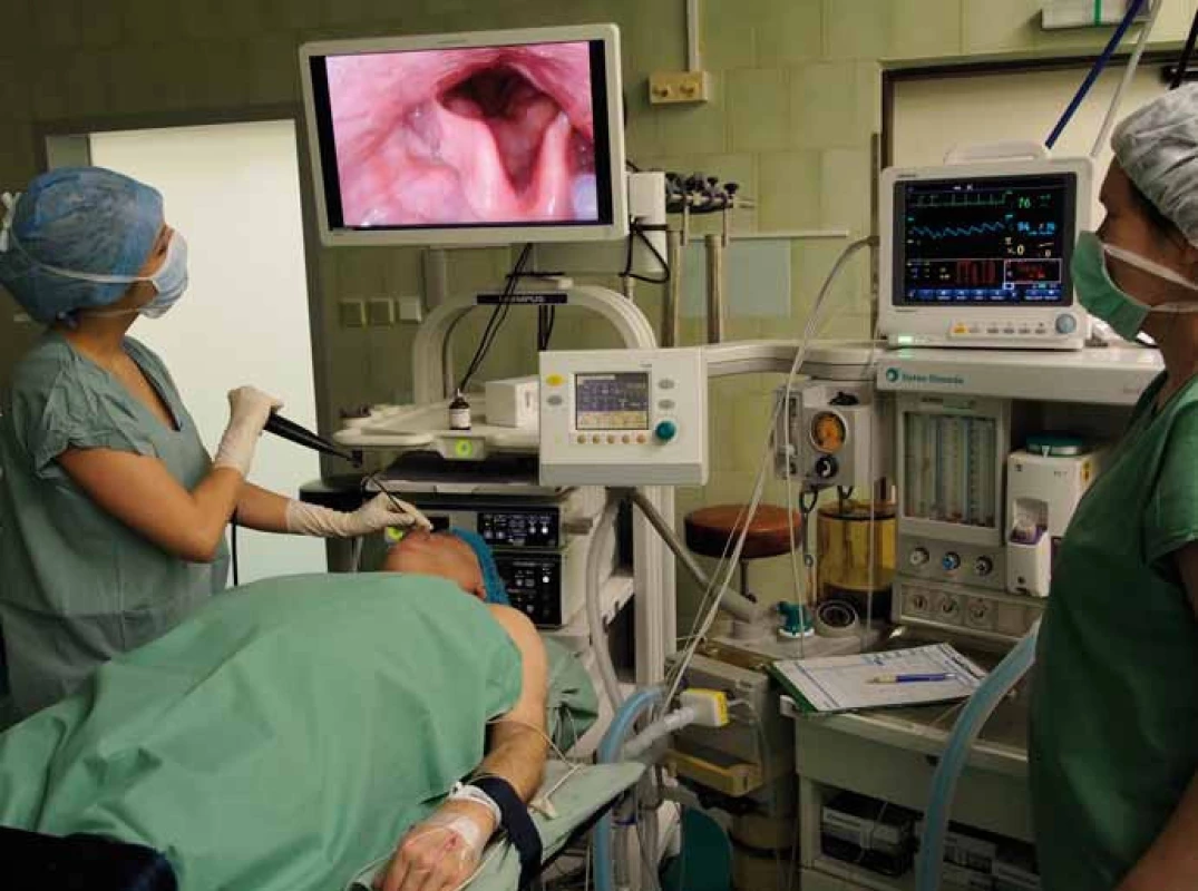 Postup při DISE vyšetření u pacienta s OSAS na operačním sále.
Fig. 1. DISE procedure for examination of patients with OSAS in an operating theatre.