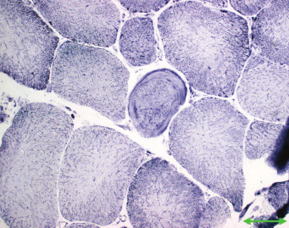 MD1. Prstenčité vlákno, na periferii cirkulárně orientované myofibrily (šipka). NADH-tetrazolium reduktáza. Úsečka – 50 μm.