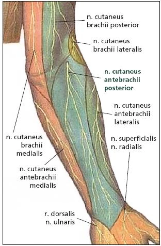 Oblast senzitivní inervace nervus cutaneus antebrachii posterior.