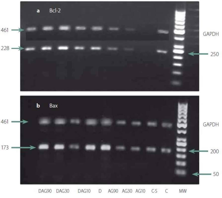 Effects of aminoguanidine (AG) on expressions of Bcl-2 (a) and Bax (b). mRNA in a rat hippocampus. Expression analyses were performed by RT-PCR and the products (10 ll) were visualized following 1.5% agarose gel electrophoresis. The intensity of the bands was quantified by densitometric analyses and normalized with corresponding GAPDH. C, control; CS, control- surgery; AG10, AG30 and AG90 controls which received aminoguanidine 10, 30 and 90 μg/rats; D, diabetic; DAG10, DAG30 and DAG90, diabetic treated with aminoguanidine 10, 30 and 90 μg/rat; M: GeneRulerTM 50 bp DNA Ladder.