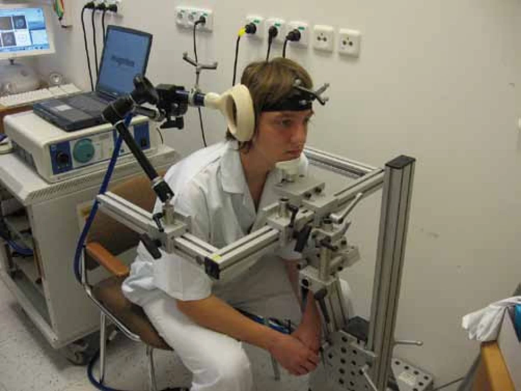 Repetitivní transkraniální magnetická stimulace pravého cerebella při bezrámové navigaci. Pomocí reflexních terčů, které jsou umístěny na cívce a na hlavě pacienta, kamerovému systému (není na snímku) a počítačovému softwaru může být stimulační cívka přesně zaměřena na cílové struktury (cívka patrná z pravé dorzální strany hlavy pacienta).