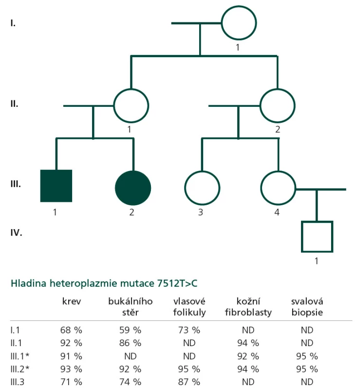 Rodokmen. Mutace 7512T&gt;C byla detekována u obou probandů (III.1., III.2), u jejich matky (II.1), babičky (I.1) a sestřenice (III.3).