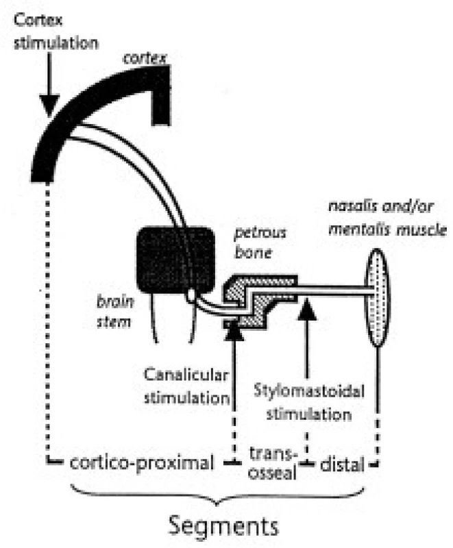 Schéma stimulačních míst v průběhu motorické dráhy lícního nervu.