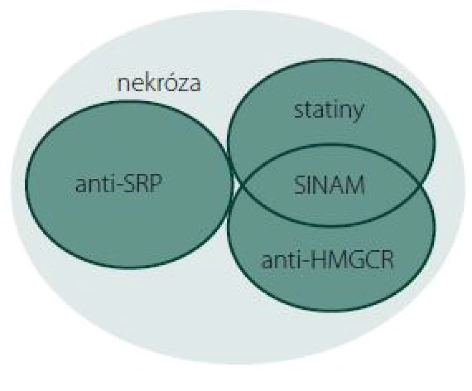 Vennův diagram podjednotek IMNM.
Anti-HMGCR+, SINAM, anti-SRP+ a skupina bez přítomnosti protilátek – klasifikace na základě serologie a terapie statiny v předchorobí.
Fig. 1. Venn diagram of IMNM subunits.
Anti-HMGCR+, SINAM, anti-SRP+, and the group without the presence of antibodies – classification based on serology and statin therapy medical history.