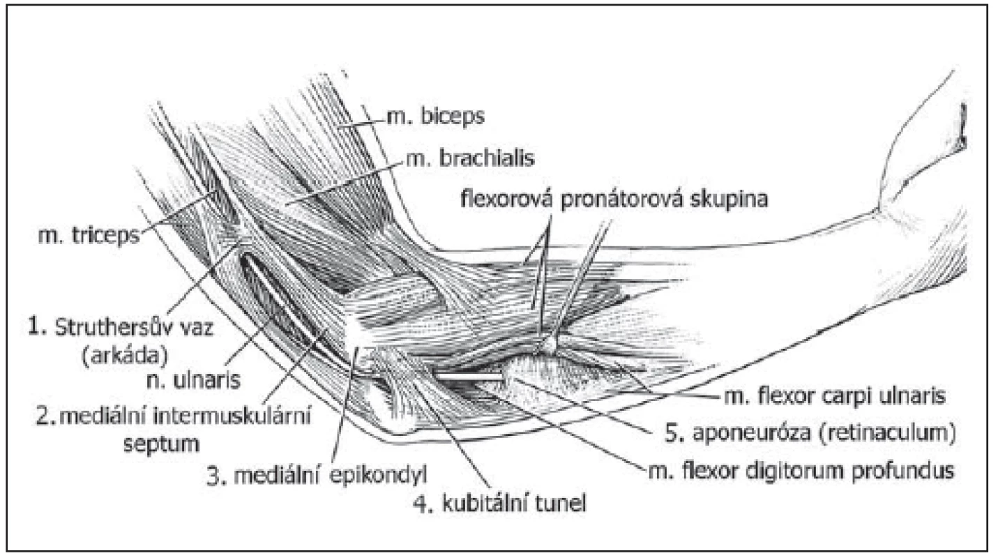 Průběh n. ulnaris v oblasti lokte [1].
Fig. 2. The course of the ulnar nerve at the elbow [1].