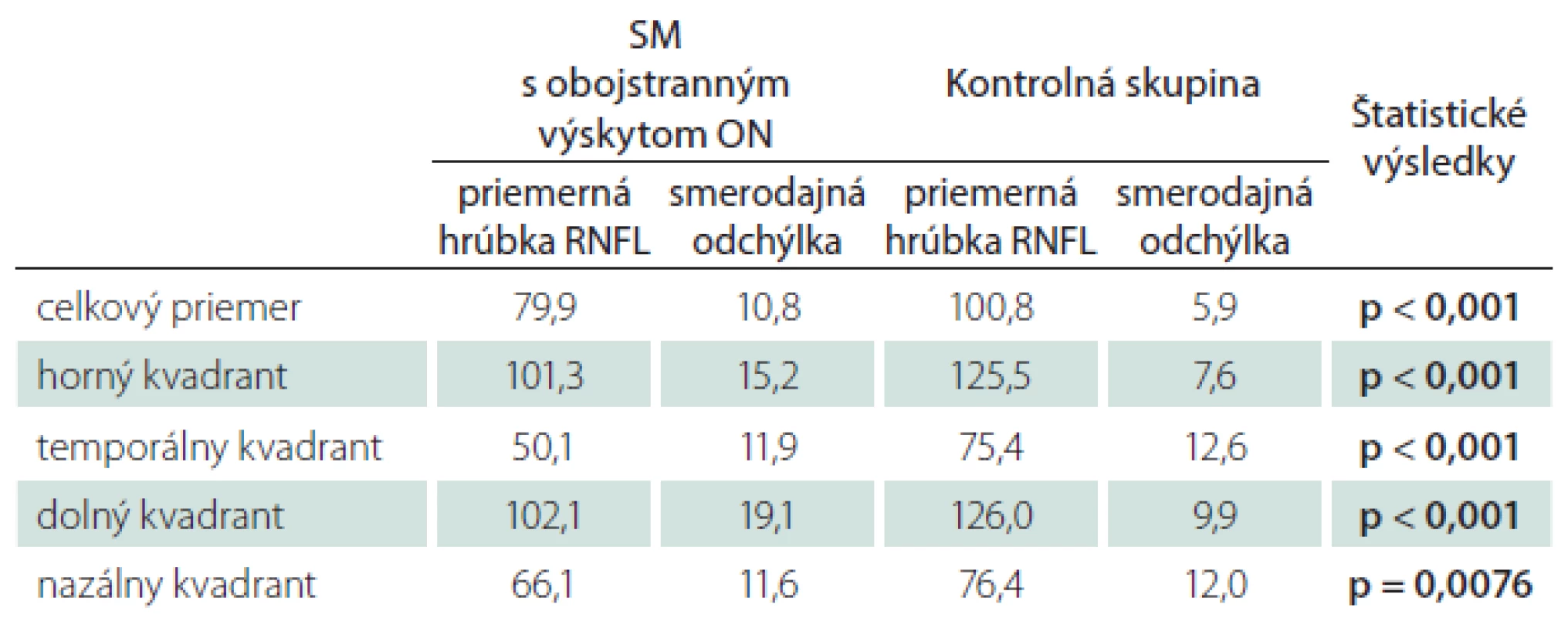 Priemerné hodnoty hrúbky RNFL u pacientov s SM a ON v anamnéze na oboch očiach. Štatistické spracovanie.