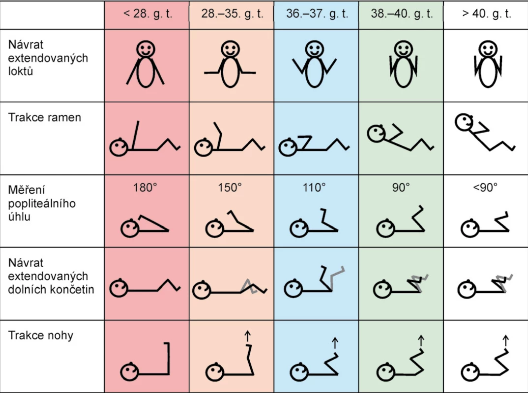 Pasivní tonus v jednotlivých stadiích gestačního věku, vytvořeno a upraveno dle [16].
Fig. 1. Passive tone in various stages of gestational age, developed and modified according to [16].