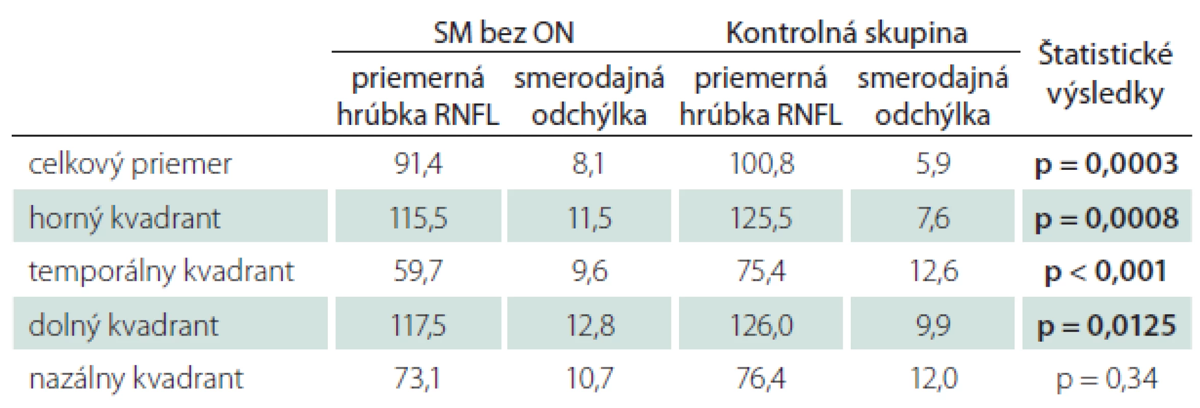 Priemerné hodnoty hrúbky RNFL u pacientov s SM bez ON v anamnéze – štatistické spracovanie.