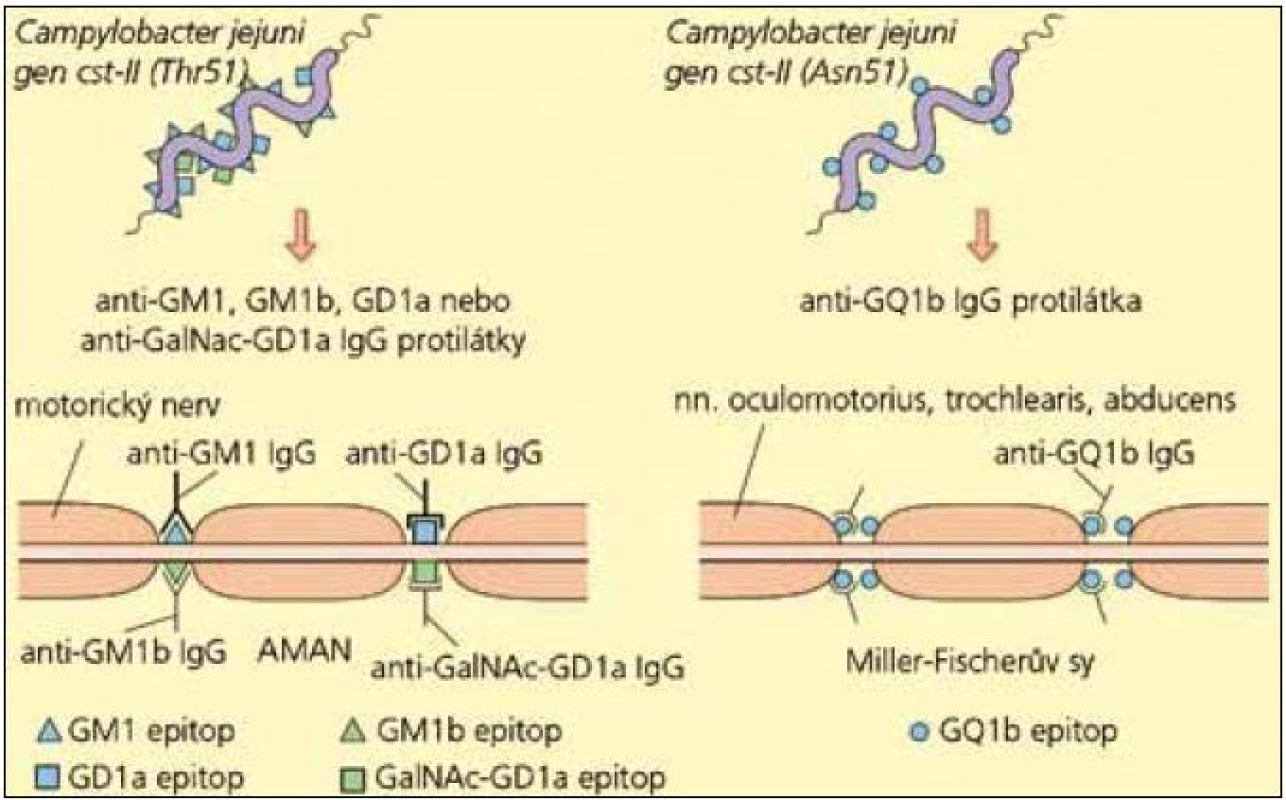 Schéma rozvoje GBS nebo MFS podle typu protilátek (upraveno podle [5]).
Při infekci Campylobacterem jejuni a produkci protilátek anti-GM1, GM1b, GD1a nebo GalNAc-GD1a dochází k postižení periferních motorických nervů, které obsahují obdobné epitopy a rozvíjí se axonální forma GBS (AMAN). Při produkci anti-GQ1b protilátek se rozvíjí MFS, protože GQ1b epitopy jsou hustě lokalizovány jen na okohybných nervech.