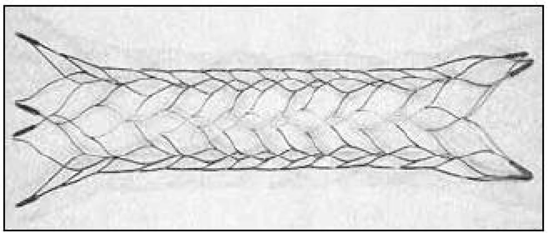 Enterprise&lt;sup&gt;TM&lt;/sup&gt; stent (Cordis Neurovascular, Miami Lakes, FL, USA).
Available from: URL: http://www.depuy.com/healthcare-professionals/product-details/enterprise-vascularreconstruction-device-and-delivery-syst.