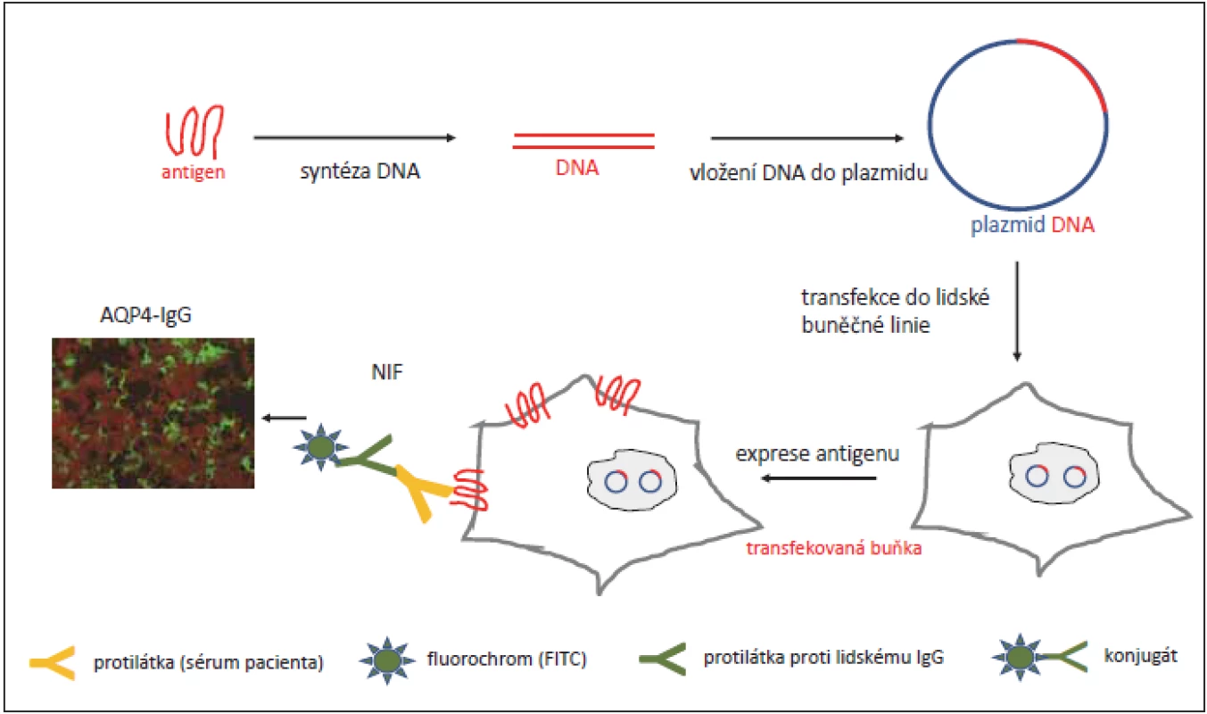 Schéma transfekce genu pro AQP4 (plazmid) do lidské buněčné linie (např. HEK293) s jeho následnou expresí.<br>
Fig. 1. Diagram of the transfection of a plasmid encoding AQP4 in a human cell line. Transfected cells express AQP4 in the plasma
membrane.
