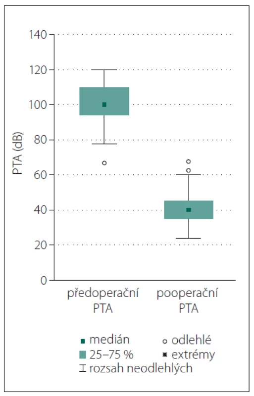 Krabicové diagramy před- a pooperačního
PTA.<br>
PTA – průměrná tónová ztráta<br>
Fig. 1. Boxplots of PTA pre- and
postoperatively.<br>
PTA – pure tone average