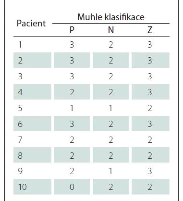 Muhle klasifikace u jednotlivých
pacientů ve flexi, neutrální poloze
a extenzi.