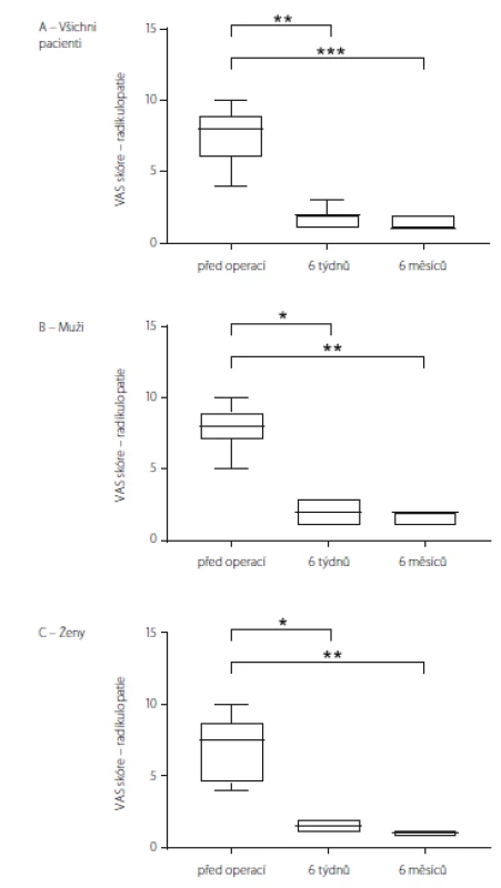 VAS skoŕe charakteru radikulopatií u souboru jako celku (A), u mužů (B) a u žen (C).
Data jsou vyjádřena jako medián, 25/75 percentil a min/max.
* p < 0,05; ** p < 0,01; *** p < 0,001
VAS – Visual Analogue Scale<br>
Fig. 4. VAS score for radiculopathy in all the patients (A), in males (B) and in females (C).
Data are expressed as median, 25/75 percentile and min/max values.
* p < 0.05; ** p < 0.01; *** p < 0.001
VAS – Visual Analogue Scale